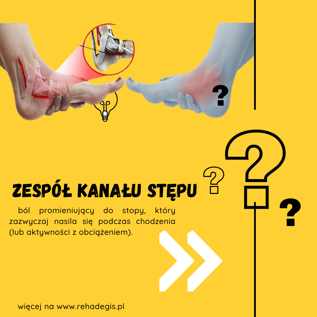 Stepu Zespół kanału stępu